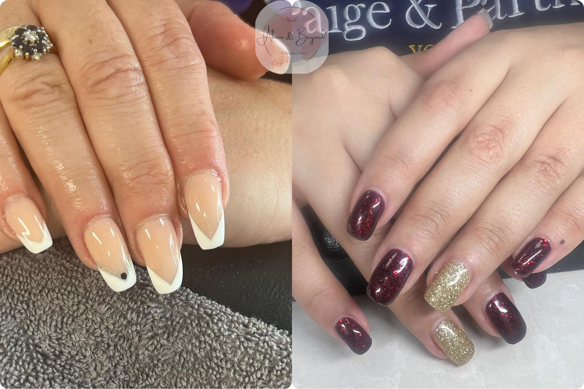 Nail Enhancement